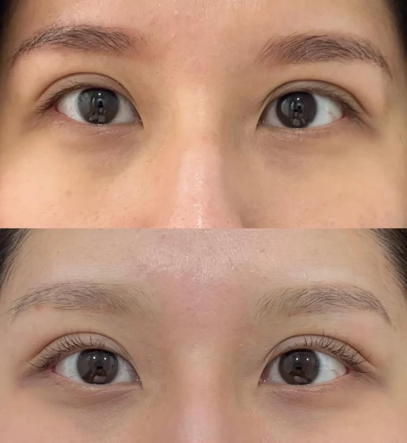 What’s The Best Eyebrow Tattoo Course In Australia?